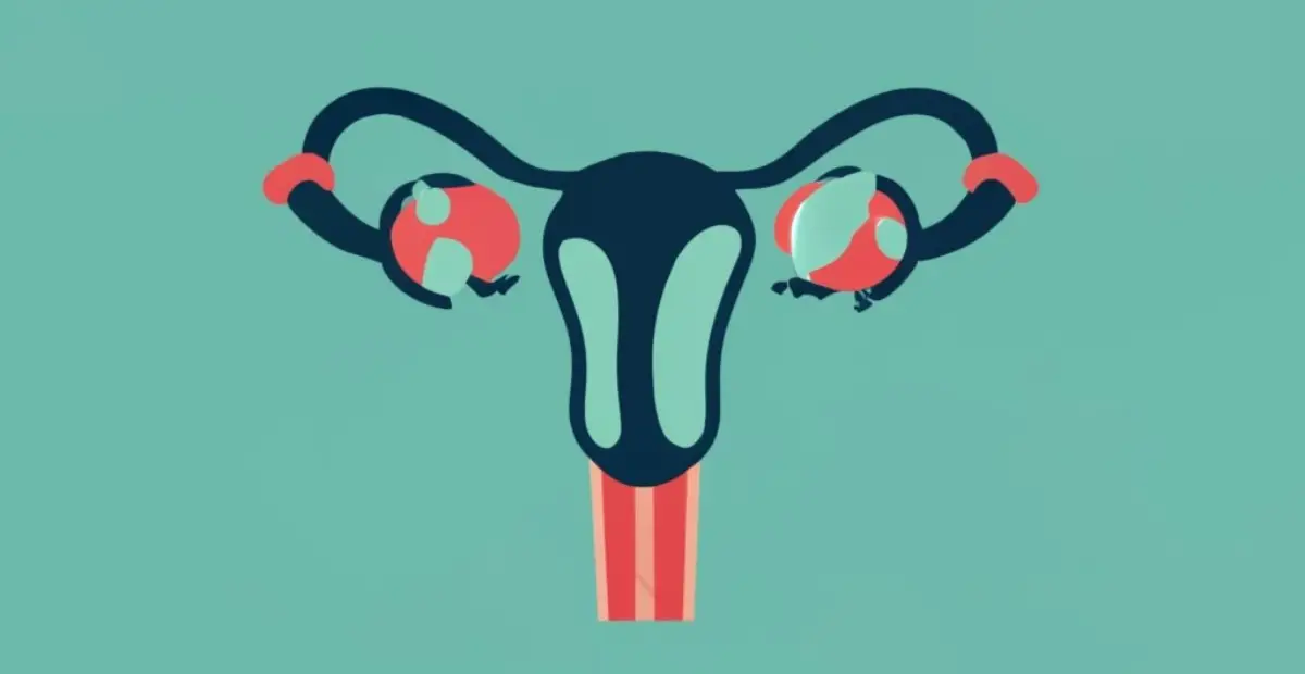 Recuperarea după operația de fibrom uterin